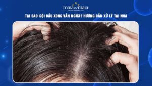 gội đầu xong vẫn ngứa