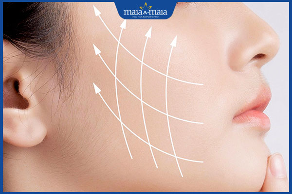 Tìm hiểu về phương pháp căng da mặt SMAS và hiệu quả thực tế 4 hiệu quả sau căng da mặt