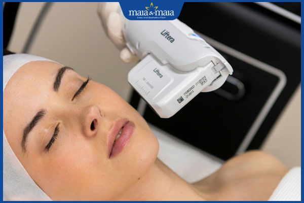 Quy trình, chi phí và địa chỉ thực hiện căng da mặt uy tín 3 hifu