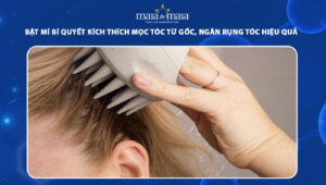 kích thích mọc tóc