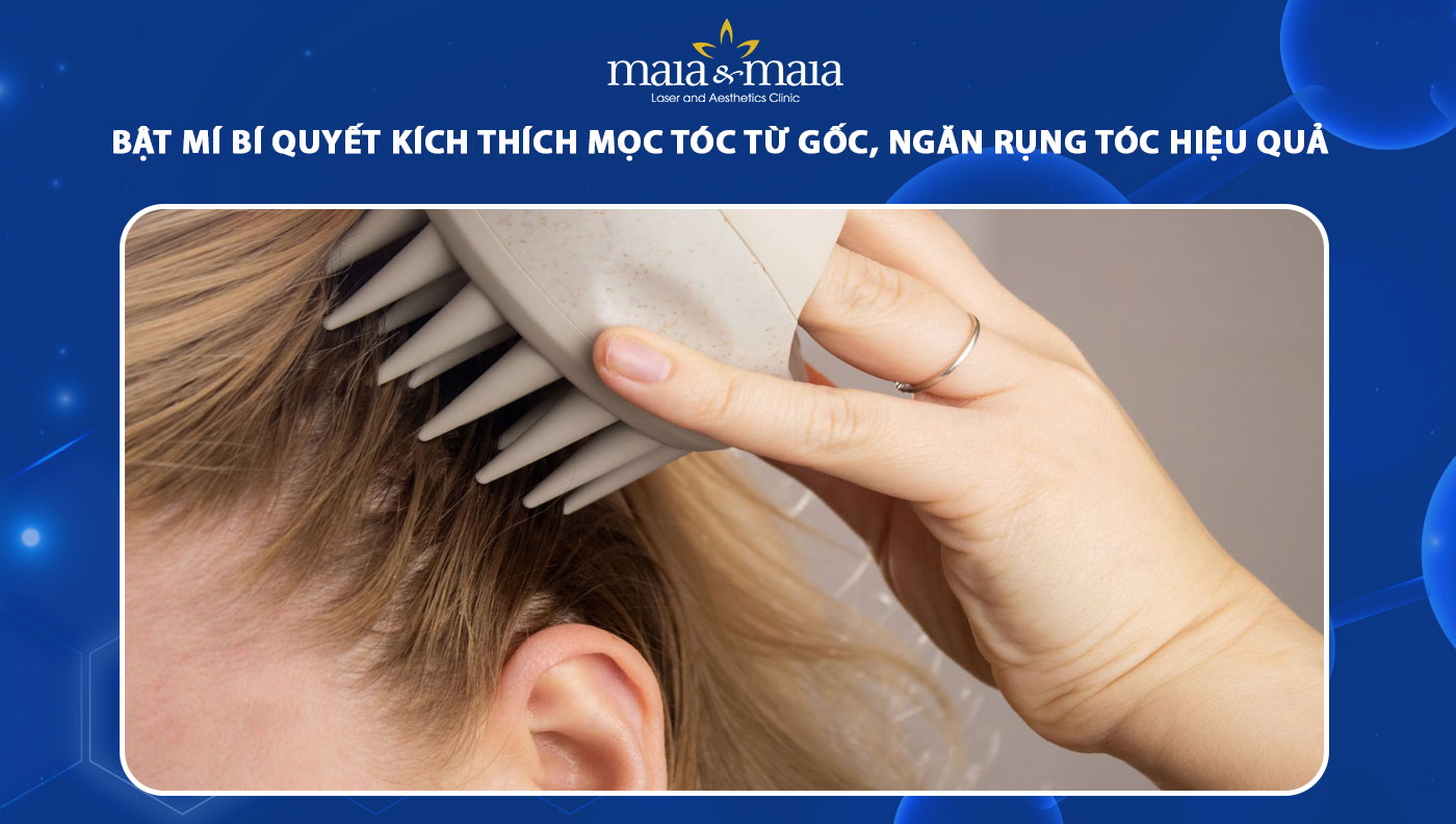 kích thích mọc tóc
