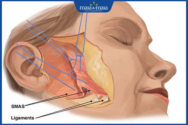 kỹ thuật căng da deep plane