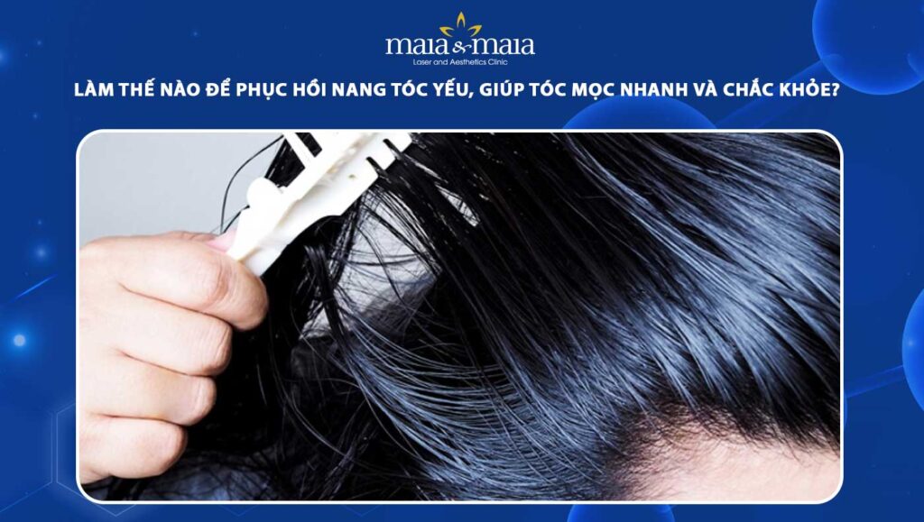 phục hồi nang tóc