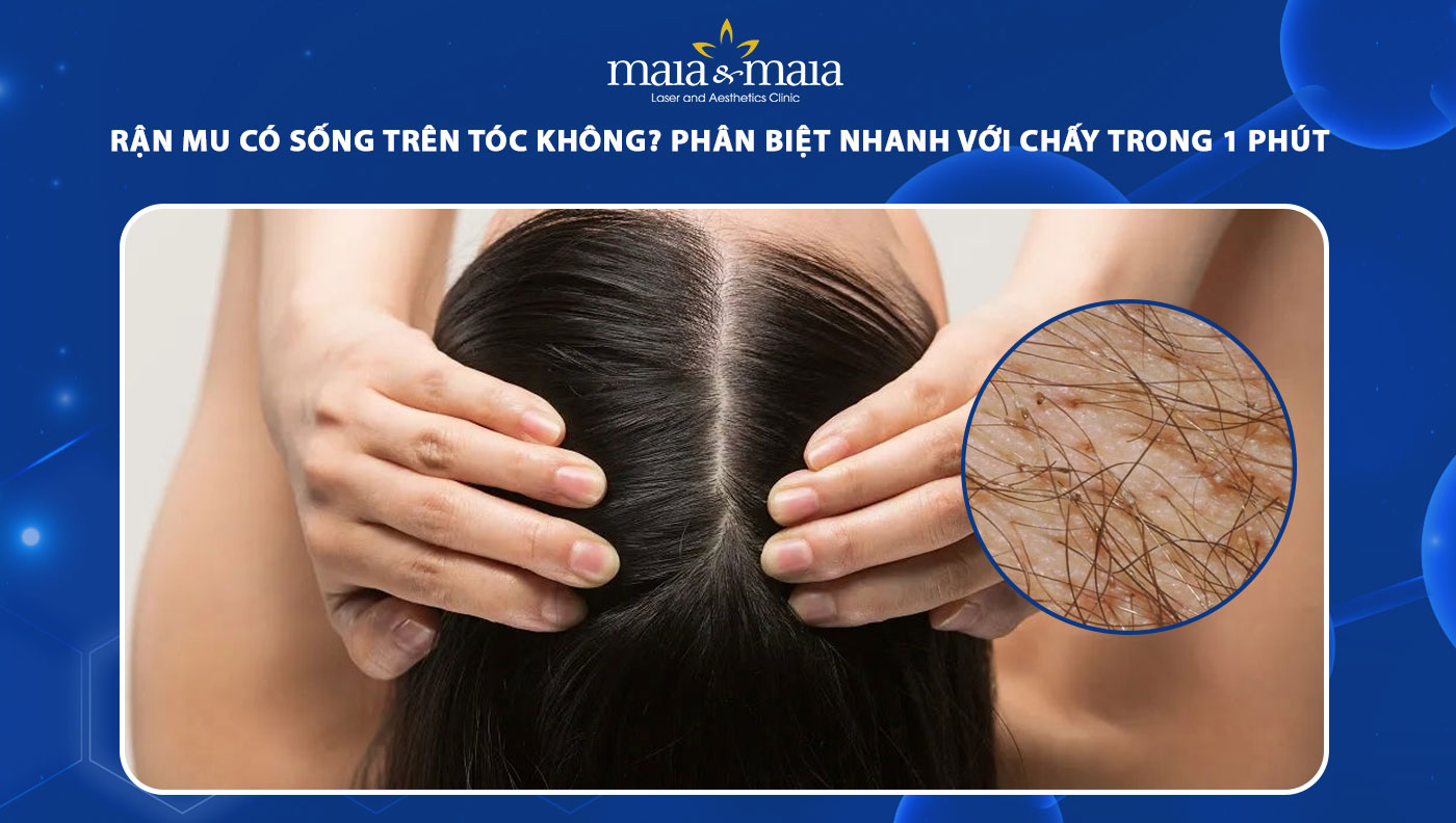 rận mu có sống trên tóc không