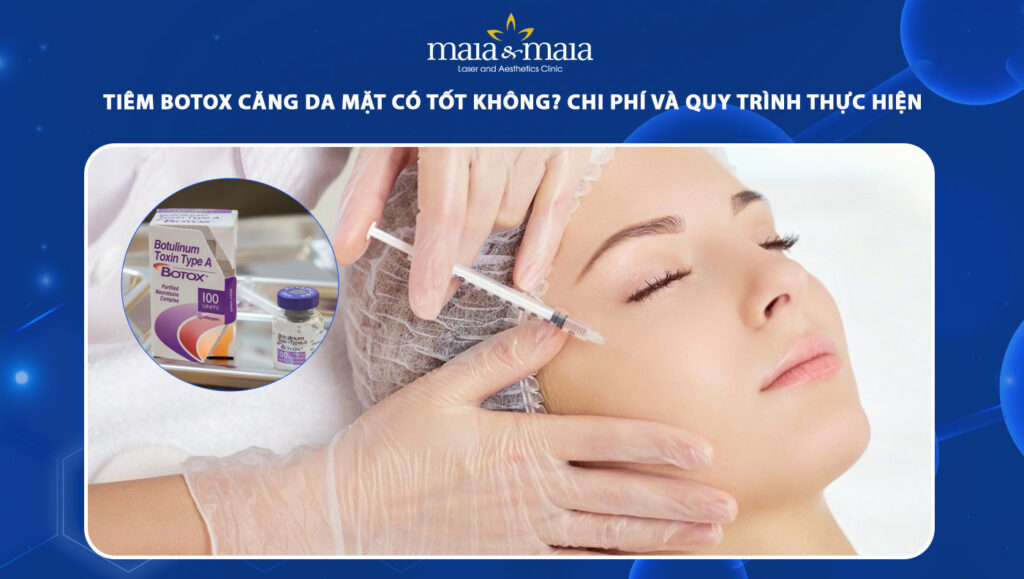 tiêm botox căng da mặt