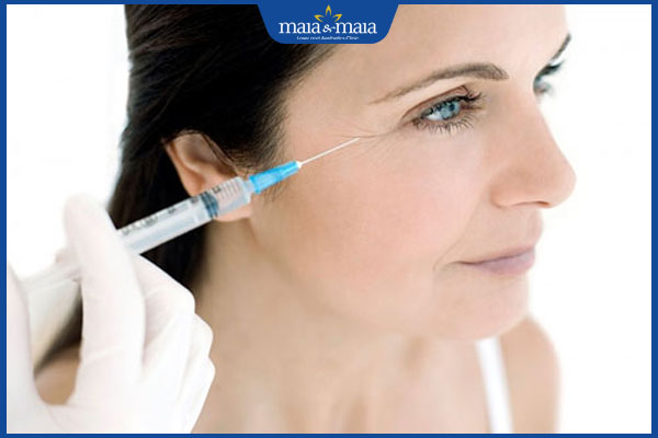 Bao nhiêu tuổi thì nên căng da mặt? Đừng làm khi chưa biết 4 tiêm filler xoa nhăn mắt