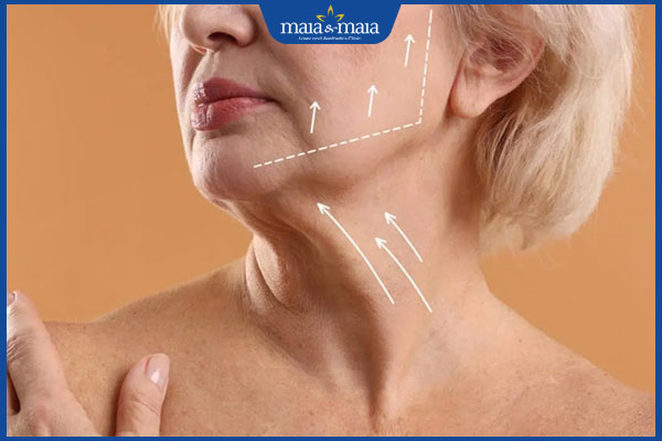 trẻ hóa khuôn mặt