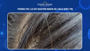 trứng tóc