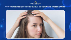 vuốt tóc nhiều có bị hói không