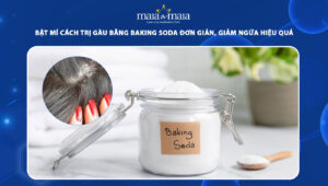 cách trị gàu bằng baking soda