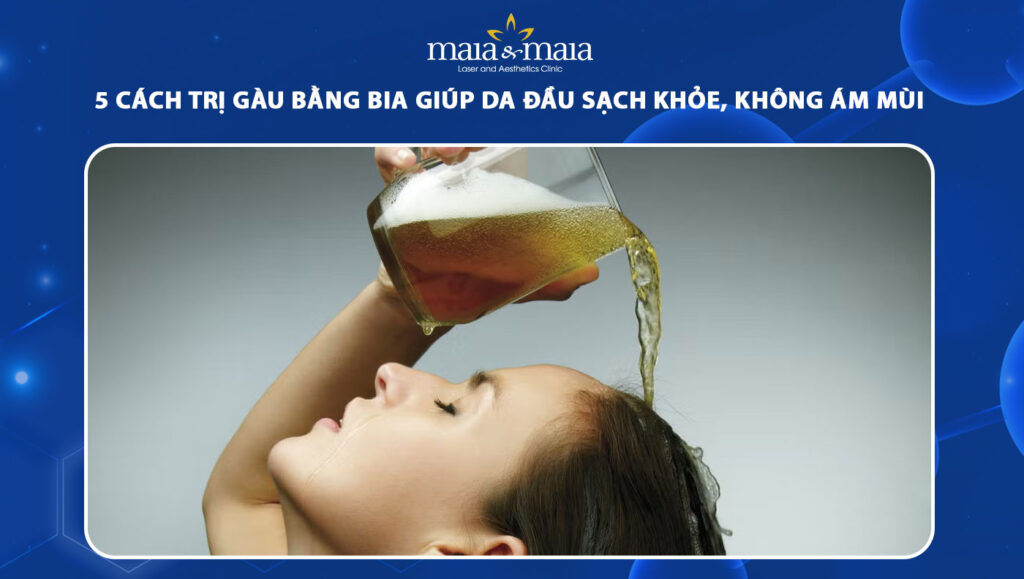 cách trị gàu bằng bia