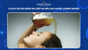cách trị gàu bằng bia