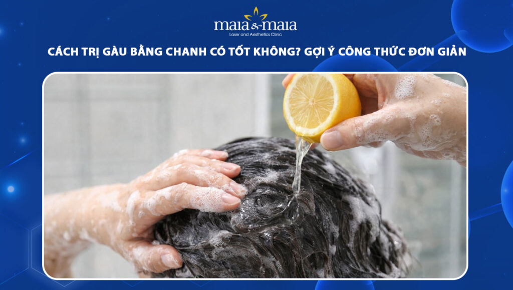 cách trị gàu bằng chanh