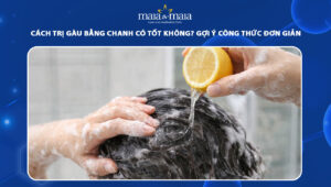 cách trị gàu bằng chanh