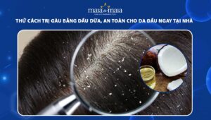 cách trị gàu bằng dầu dừa