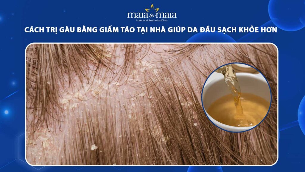 cách trị gàu bằng giấm táo