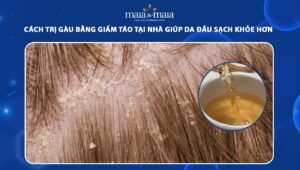 cách trị gàu bằng giấm táo