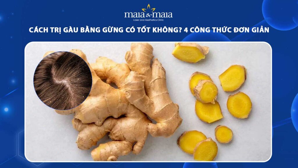 cách trị gàu bằng gừng