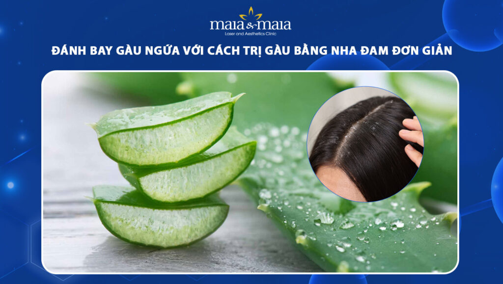 cách trị gàu bằng nha đam