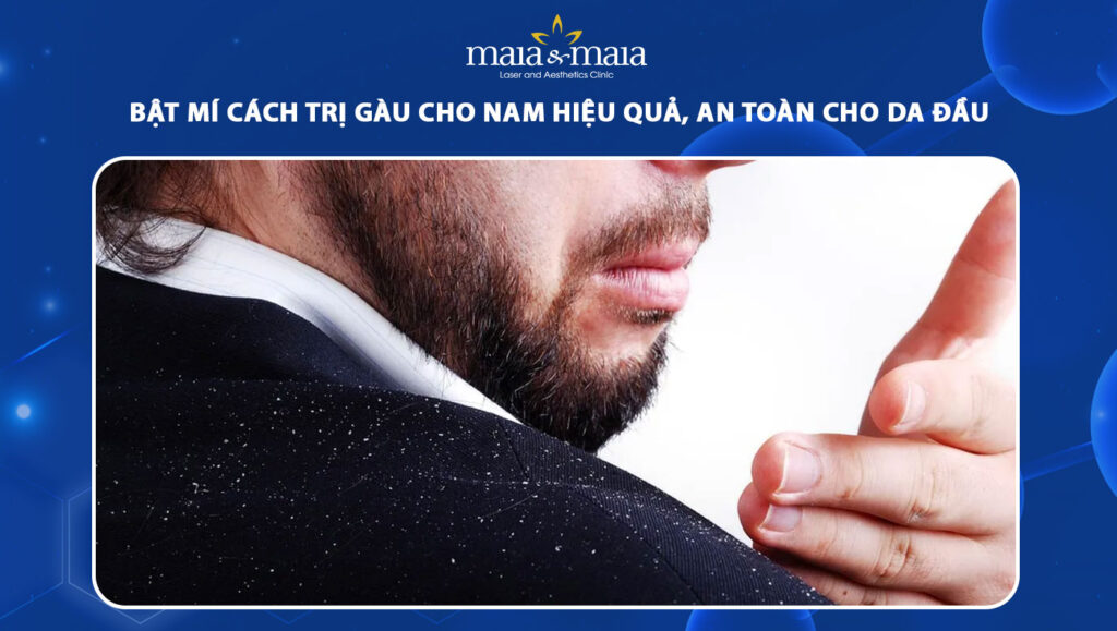 Bật mí cách trị gàu cho nam hiệu quả, an toàn cho da đầu 1 cách trị gàu cho nam