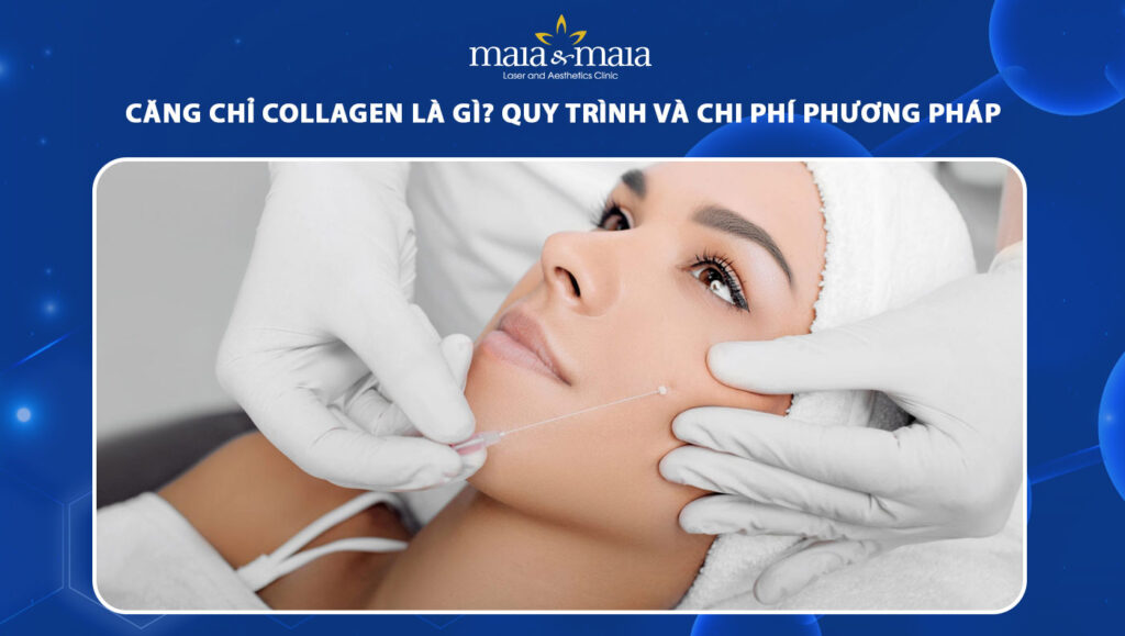 căng chỉ collagen