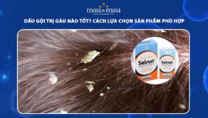 dầu gội trị gàu
