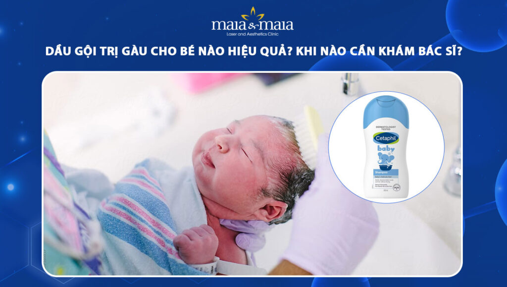 dầu gội trị gàu cho bé