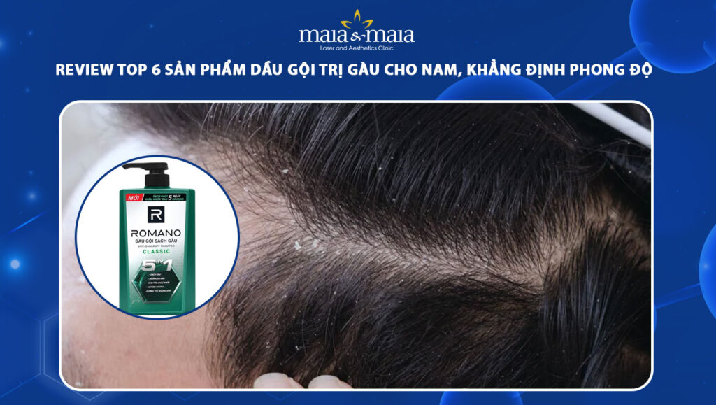 Review TOP 6 sản phẩm dầu gội trị gàu cho nam, phong độ cao 1 dầu gội trị gàu cho nam
