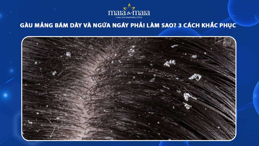 Gàu là gì? Làm sao để cải thiện da đầu sạch khỏe hơn? 1 gàu là gì