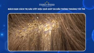 gàu ướt