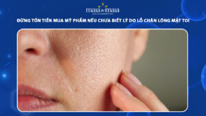 lỗ chân lông mặt to