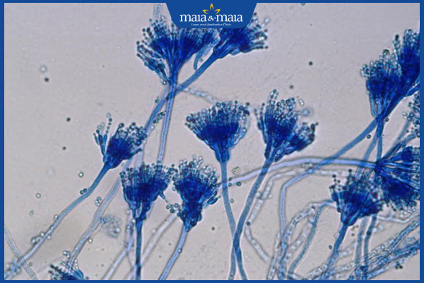 nấm aspergillosis