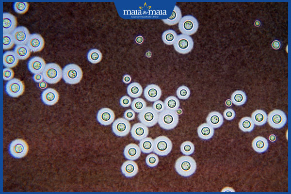 nấm cryptococcosis