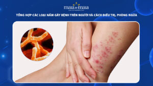 nấm gây bệnh trên người