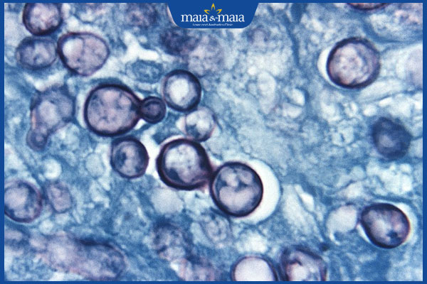 nấm histoplasmosis