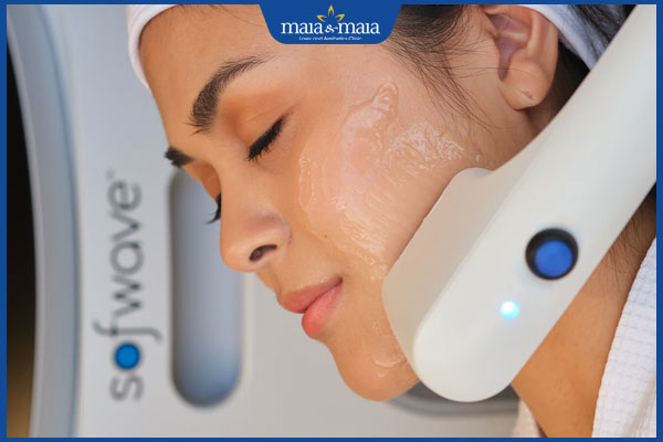 thực hiện sofwave superb