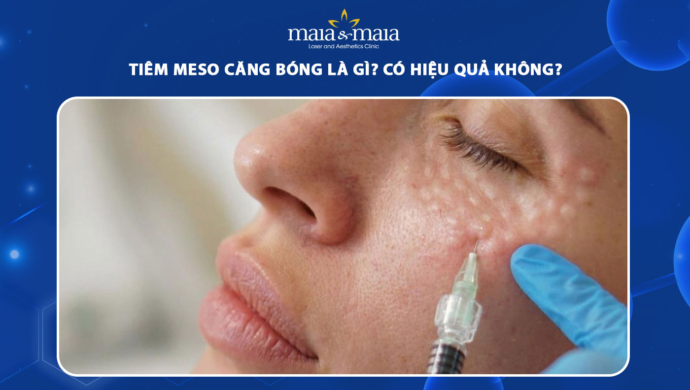 tiêm meso căng bóng