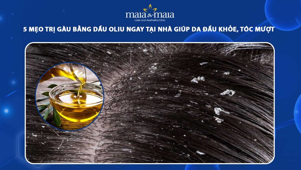trị gàu bằng dầu oliu