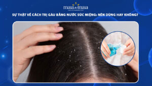 trị gàu bằng nước súc miệng