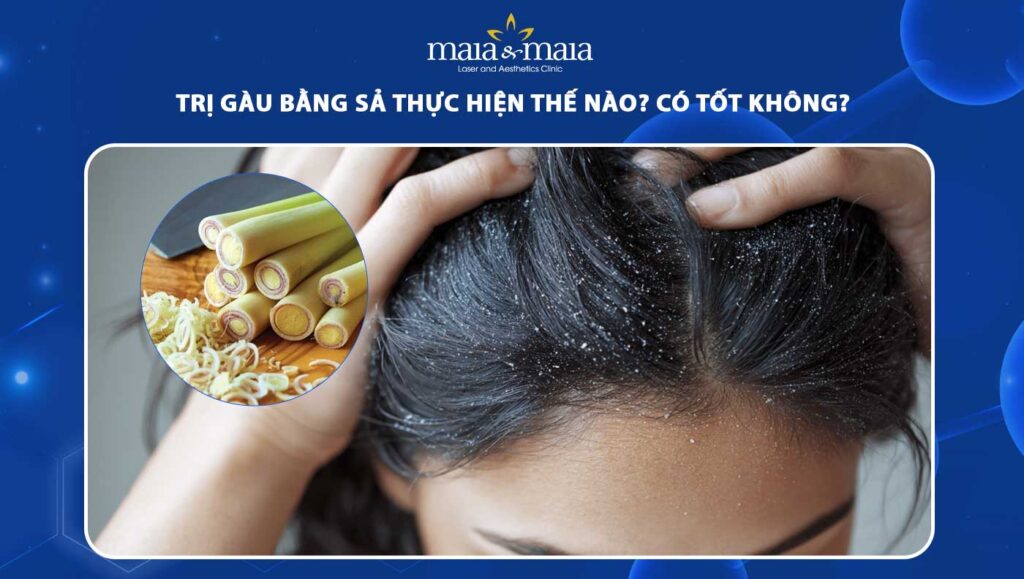 5 cách trị gàu bằng sả giúp da đầu hết ngứa, giảm bong tróc 1 trị gàu bằng sả