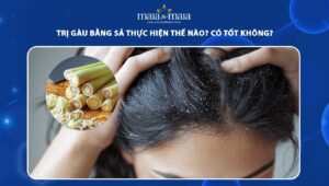 trị gàu bằng sả
