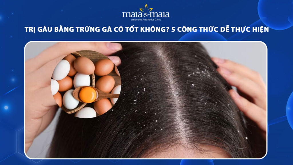 Mẹo trị gàu bằng trứng gà đơn giản tại nhà mà ít người biết 1 trị gàu bằng trứng gà