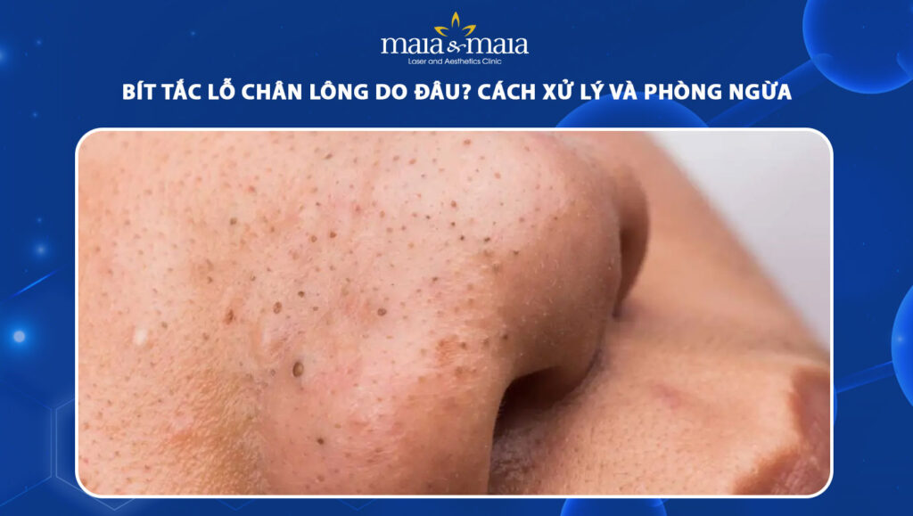 bít tắc lỗ chân lông