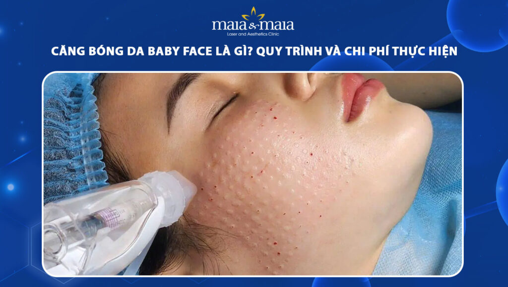 Căng bóng da Baby Face là gì? Quy trình và chi phí thực hiện 1 căng bóng da baby face