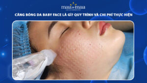 căng bóng da baby face