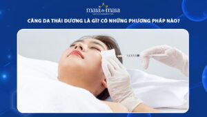 căng da thái dương