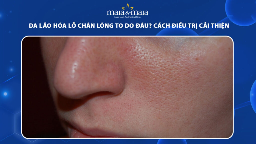 da lão hóa lỗ chân lông to