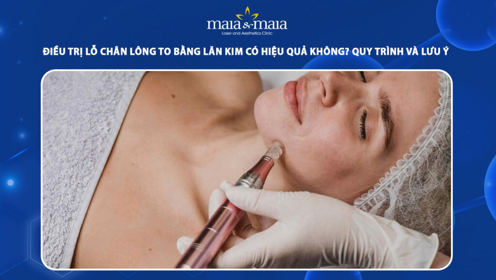 Điều trị lỗ chân lông to bằng lăn kim có hiệu quả không? 1 điều trị lỗ chân lông to bằng lăn kim