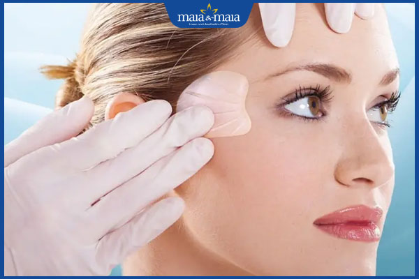 Căng da thái dương là gì? Có những phương pháp nào? 3 độn thái dương