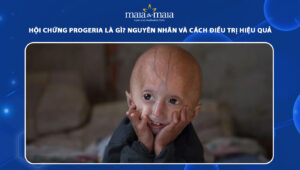 hội chứng Progeria